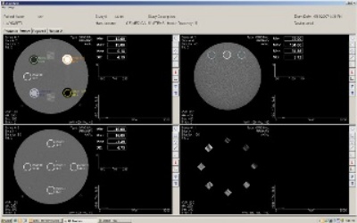 MODEL 464-ACTS AUTOMATED CT SOFTWARE FOR THE GAMMEX 464 ACR ACCREDITATION PHANTOM