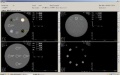 Model 464-ACTS Automated CT Software for the Gammex 464 ACR Accreditation Phantom